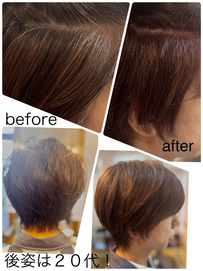 グレーカラーメソッド